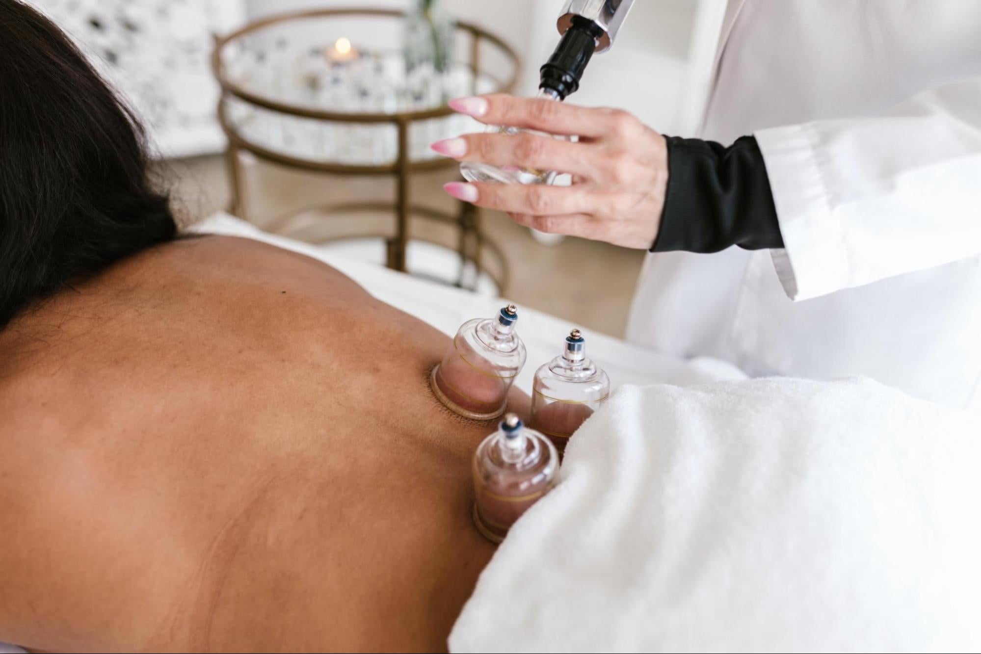 Person getting cupping therapy done